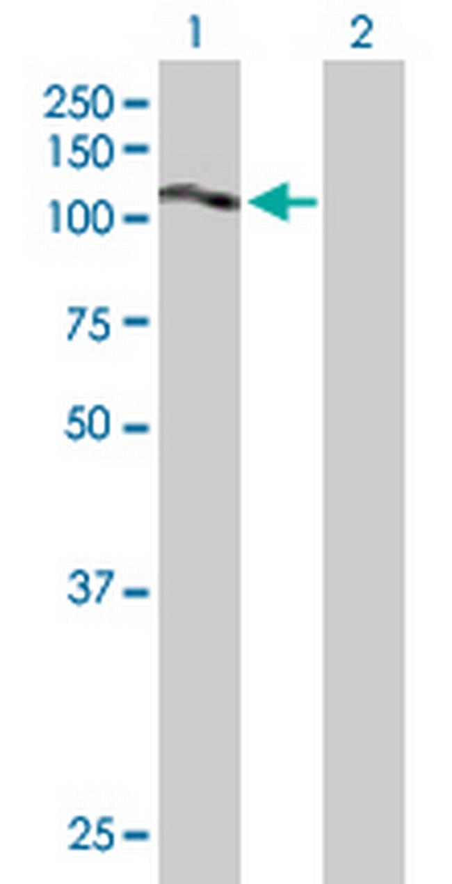 SLC20A2 Antibody in Western Blot (WB)