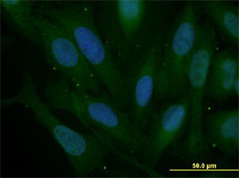 SNAI2 Antibody in Immunocytochemistry (ICC/IF)