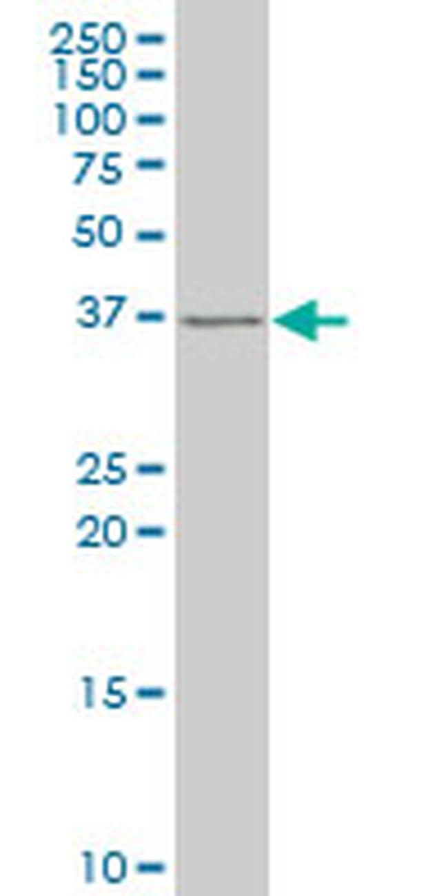 SNAI2 Antibody in Western Blot (WB)