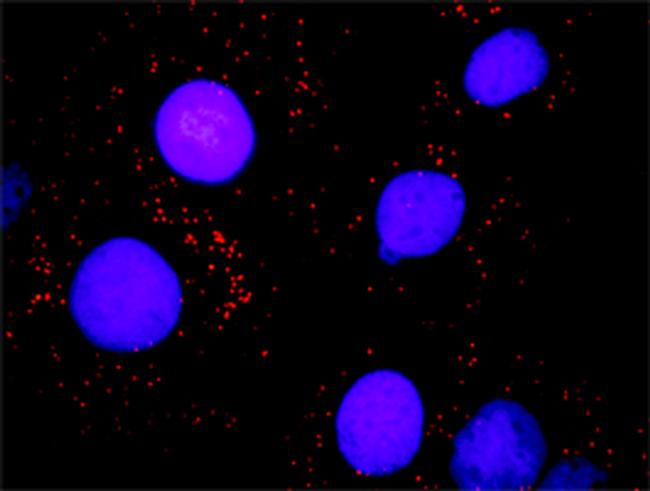 SMARCB1 Antibody in Proximity Ligation Assay (PLA) (PLA)