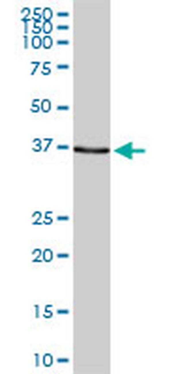 SMARCB1 Antibody in Western Blot (WB)