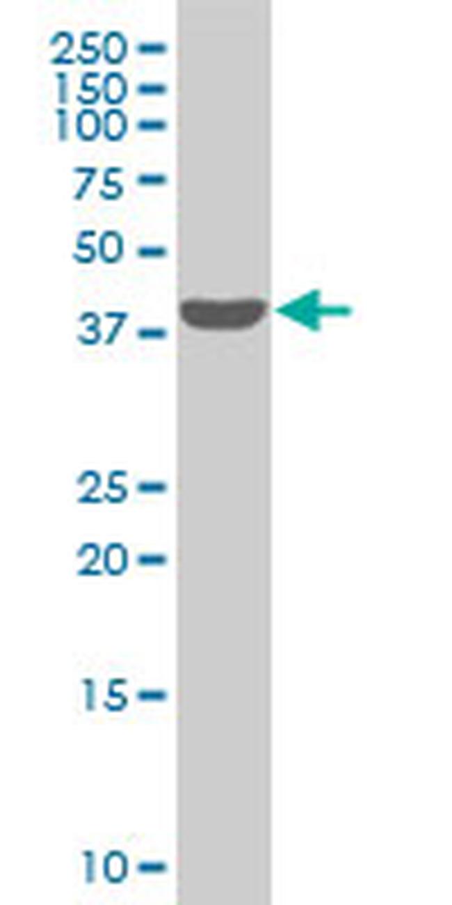 SMARCB1 Antibody in Western Blot (WB)