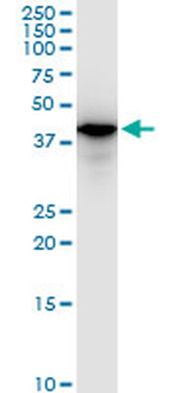 SMARCB1 Antibody in Western Blot (WB)