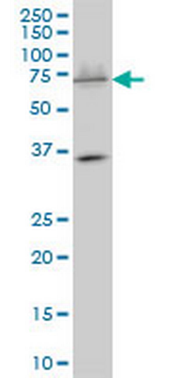 SMARCD3 Antibody in Western Blot (WB)