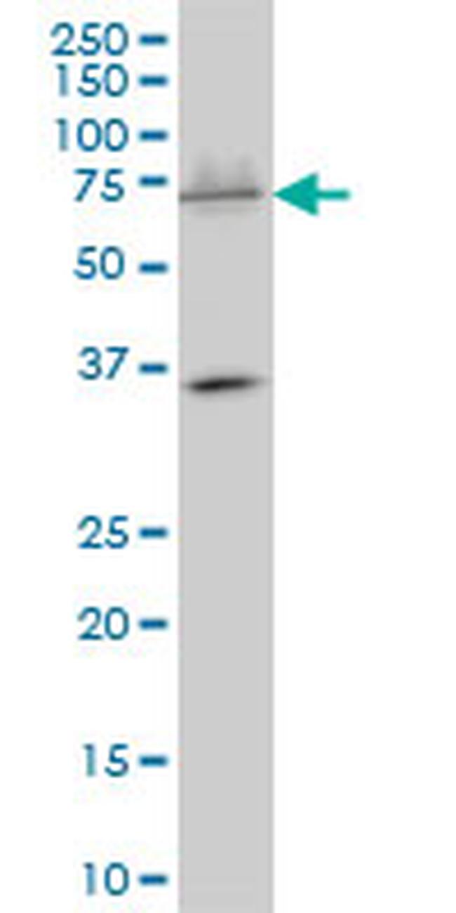 SMARCD3 Antibody in Western Blot (WB)