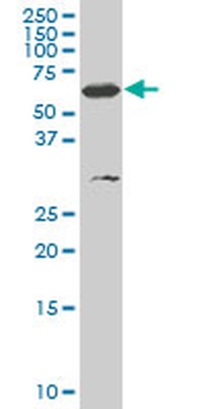 SMARCD3 Antibody in Western Blot (WB)