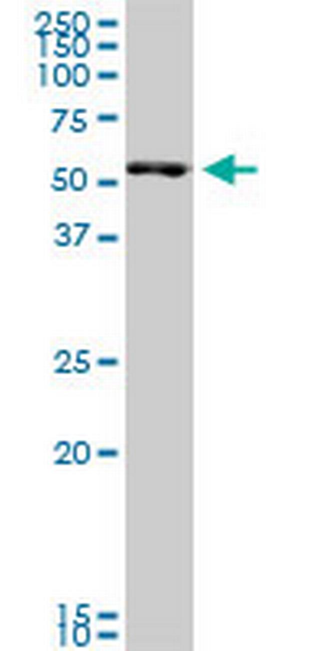 SMARCD3 Antibody in Western Blot (WB)