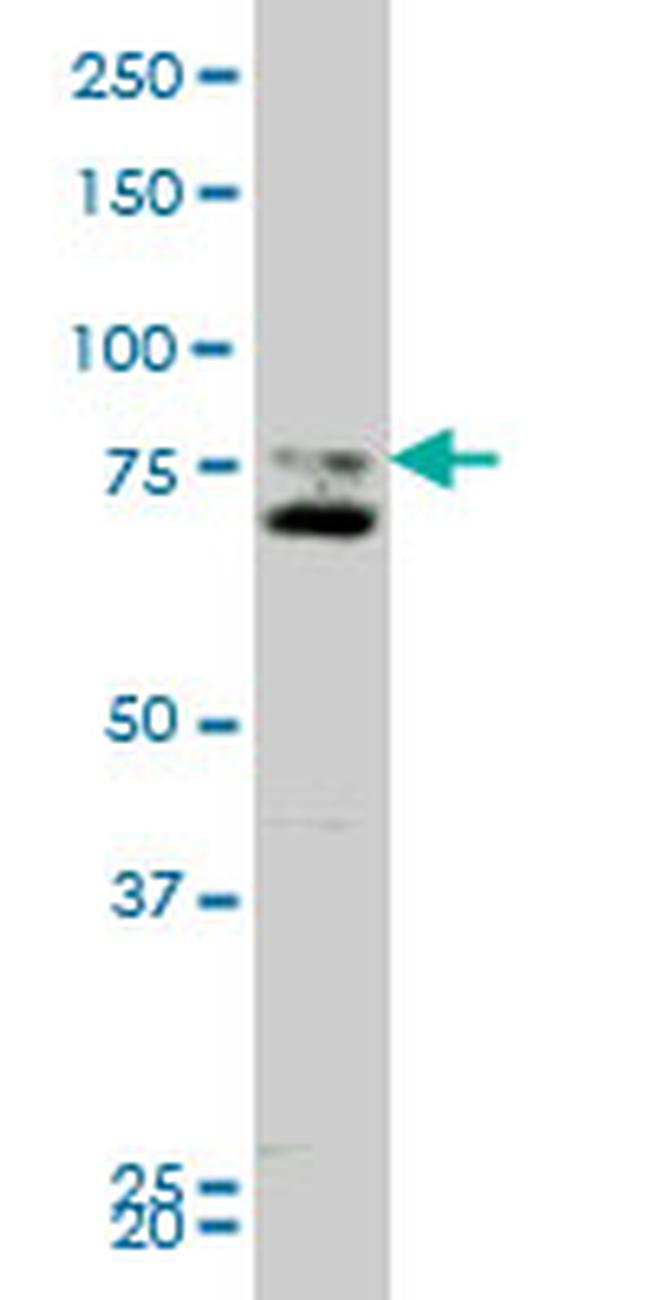 SMO Antibody in Western Blot (WB)