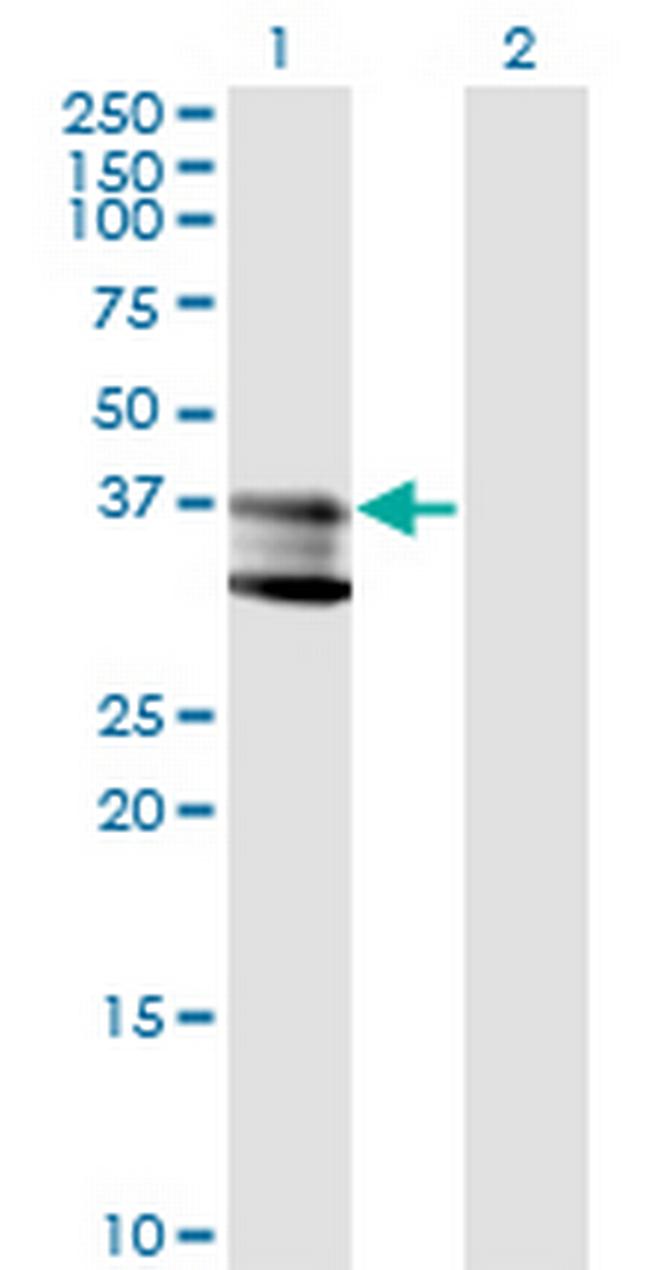 SMPD1 Antibody in Western Blot (WB)