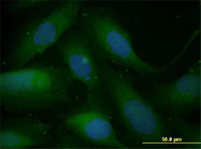 SNAI1 Antibody in Immunocytochemistry (ICC/IF)