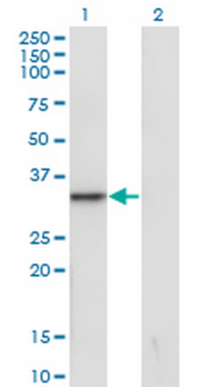 SNAI1 Antibody in Western Blot (WB)