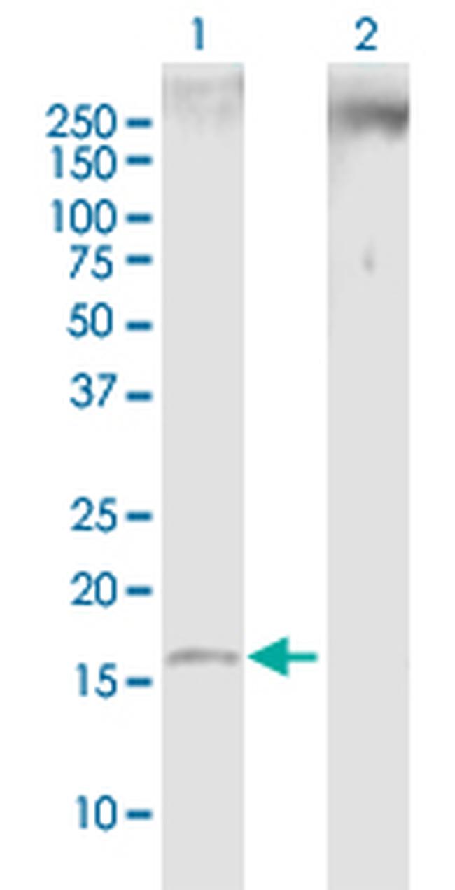 SNCB Antibody in Western Blot (WB)