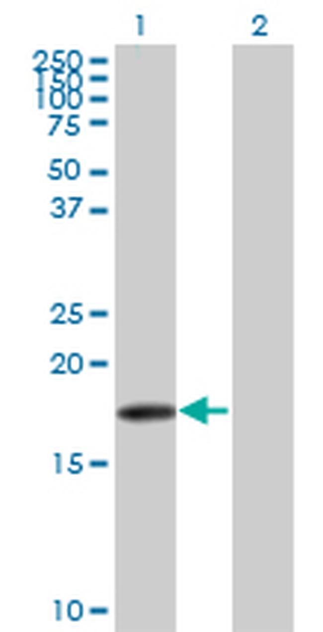 SNCB Antibody in Western Blot (WB)