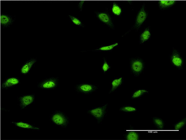 SNAPC4 Antibody in Immunocytochemistry (ICC/IF)