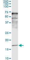 SNCA Antibody in Immunoprecipitation (IP)