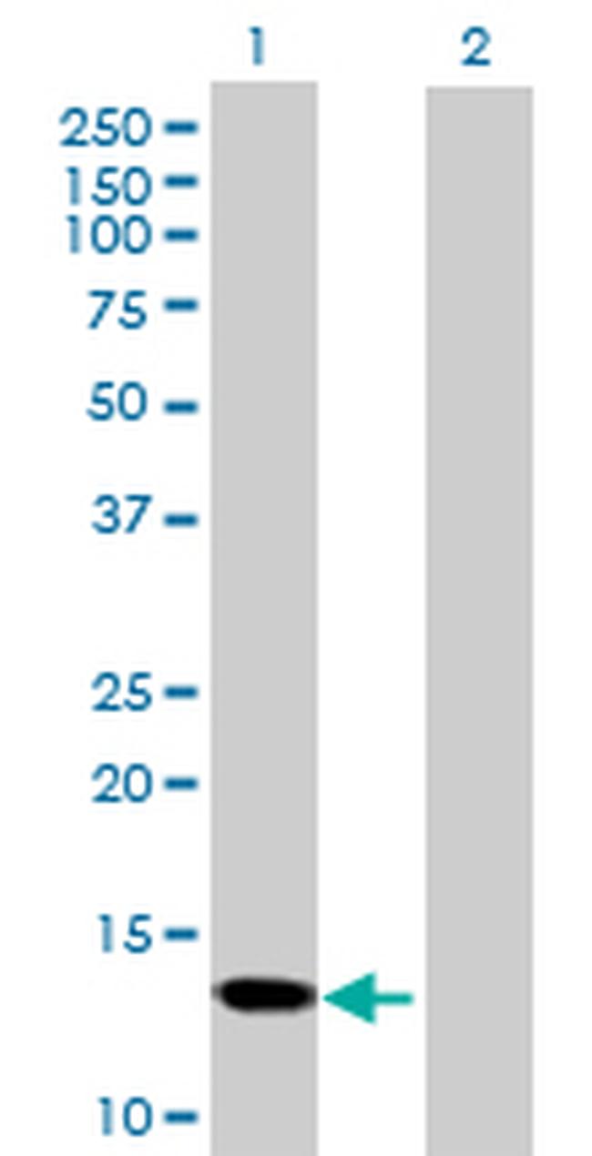 SNCG Antibody in Western Blot (WB)