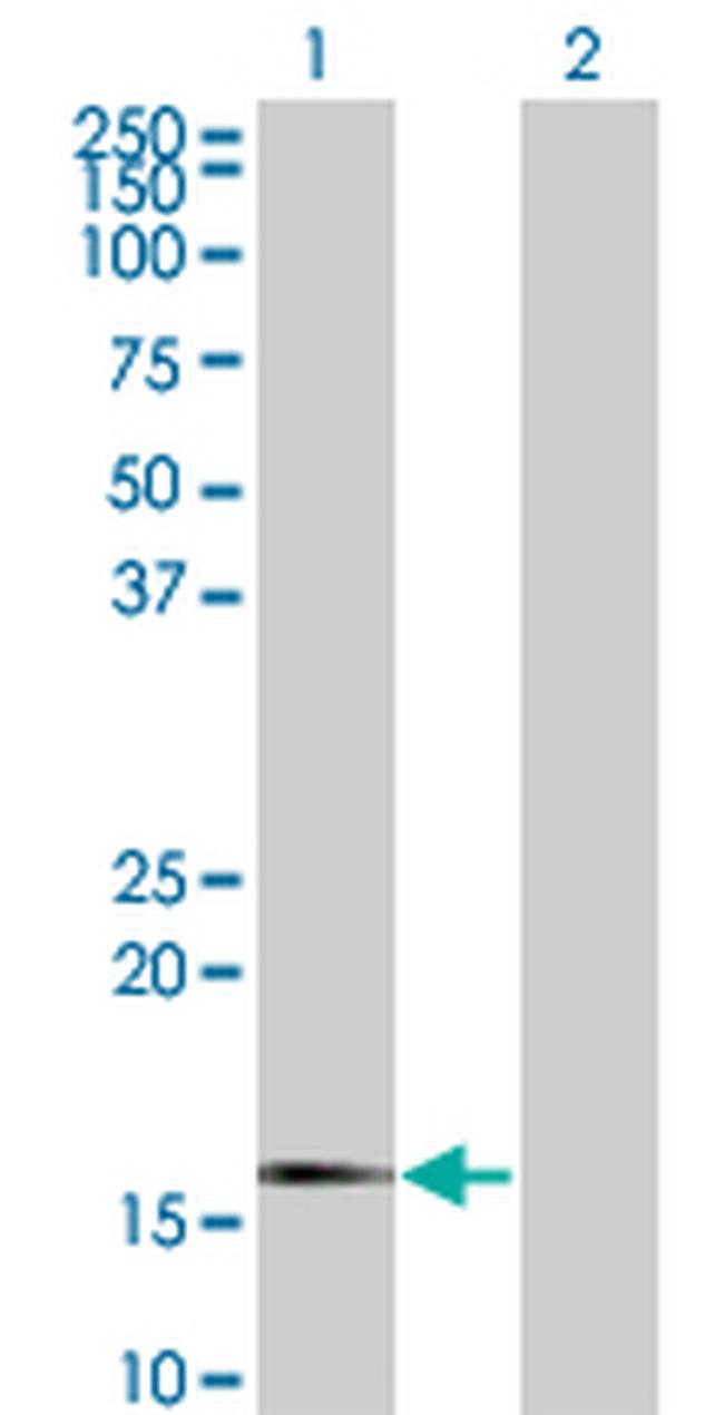 SNCG Antibody in Western Blot (WB)