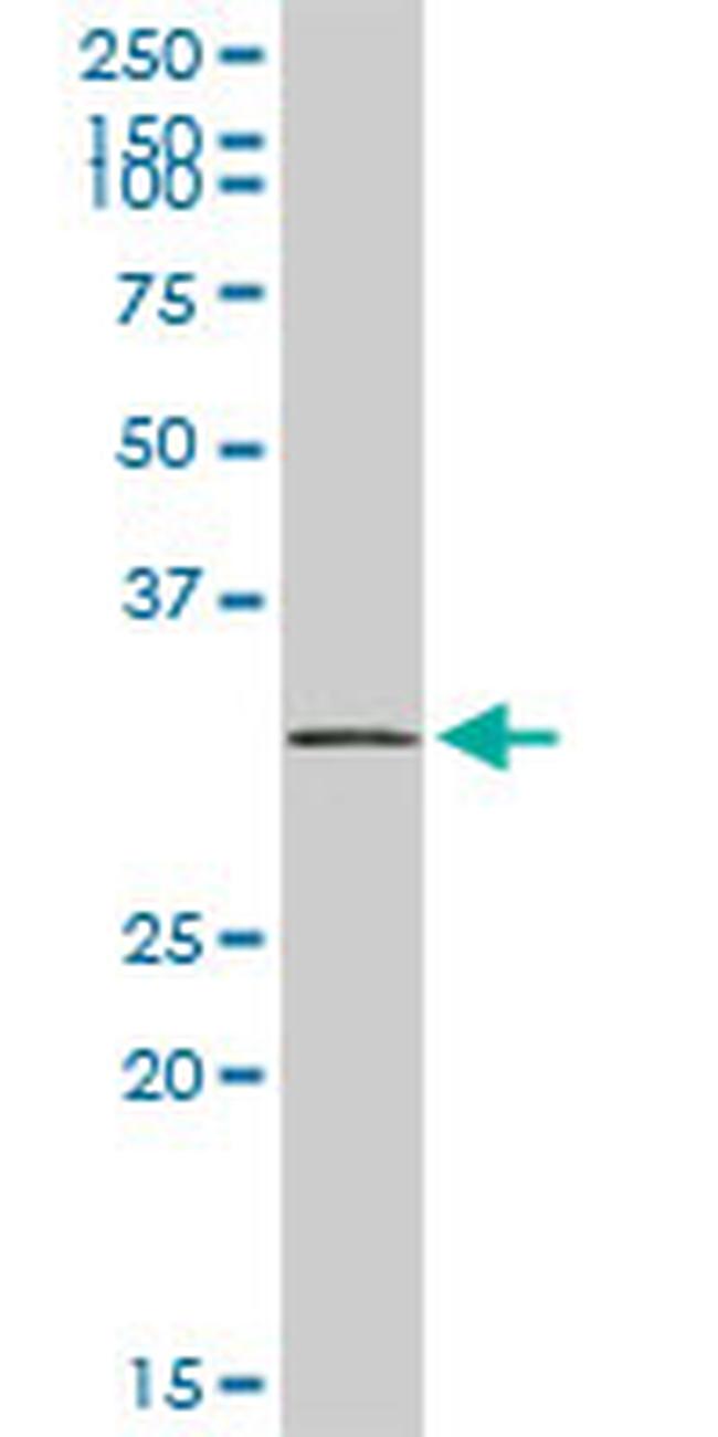 SNRPA Antibody in Western Blot (WB)