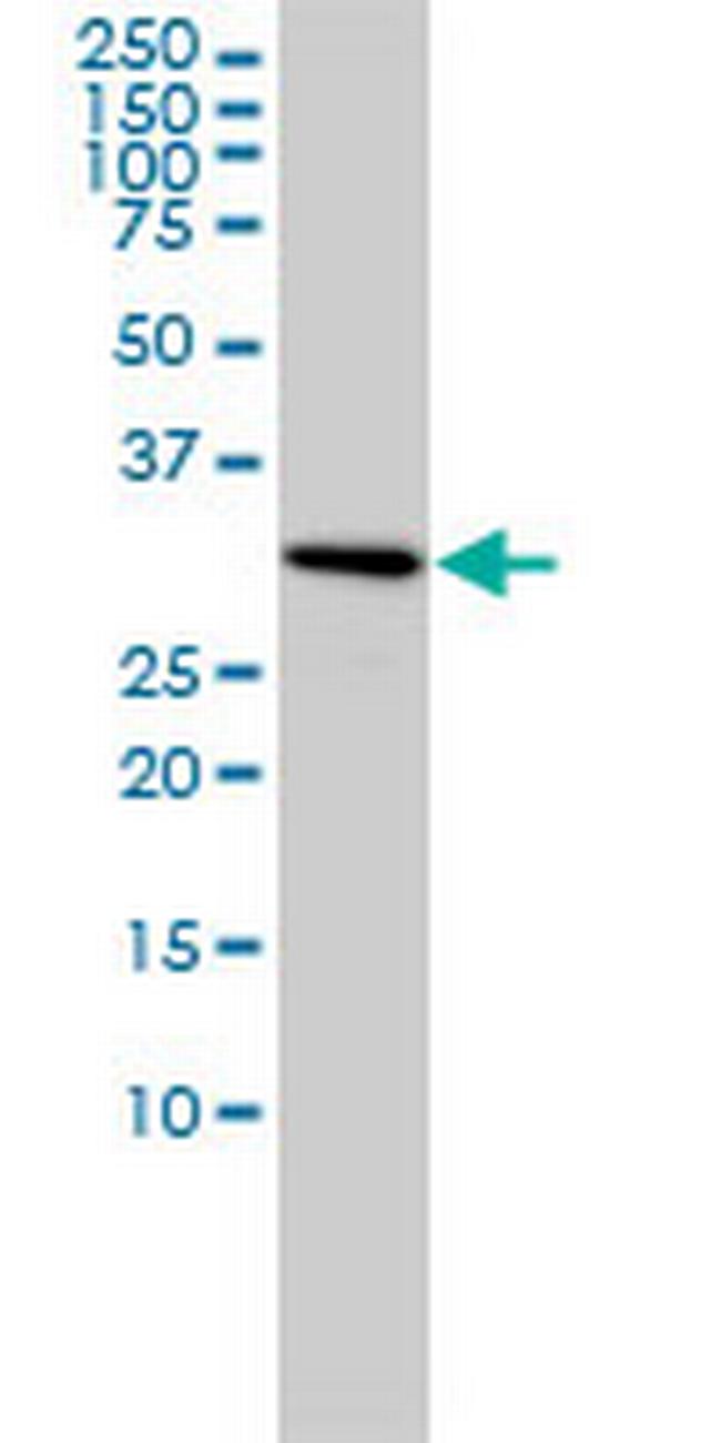 SNRPA Antibody in Western Blot (WB)