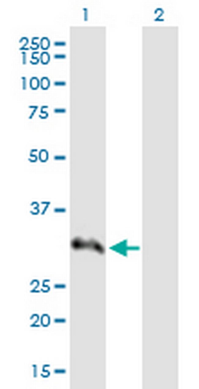 SNRPA1 Antibody in Western Blot (WB)