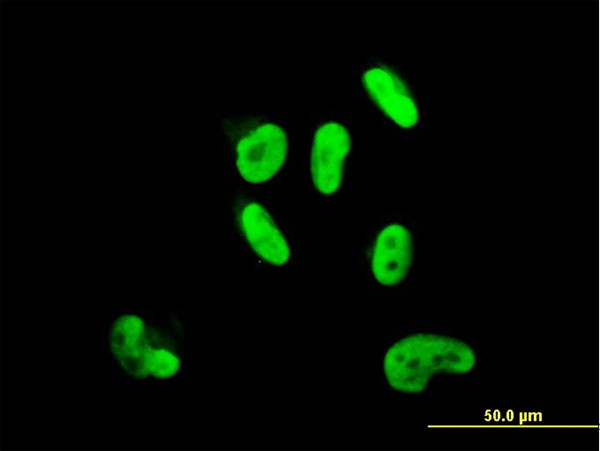 SOX9 Antibody in Immunocytochemistry (ICC/IF)