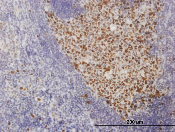 SOX9 Antibody in Immunohistochemistry (Paraffin) (IHC (P))