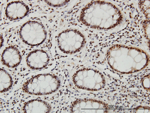 SP1 Antibody in Immunohistochemistry (Paraffin) (IHC (P))