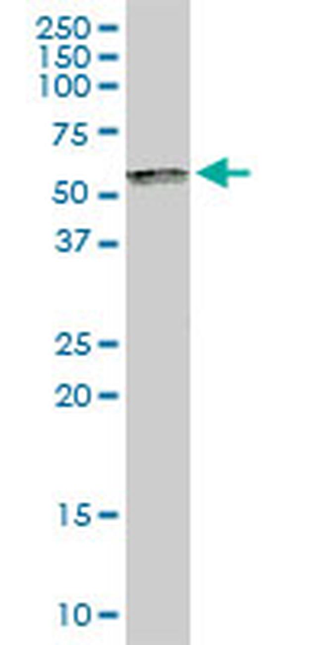 SP100 Antibody in Western Blot (WB)