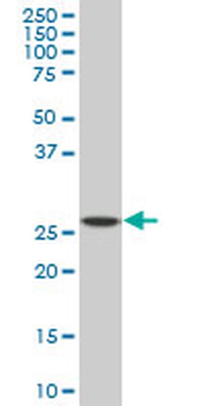 SPI1 Antibody in Western Blot (WB)