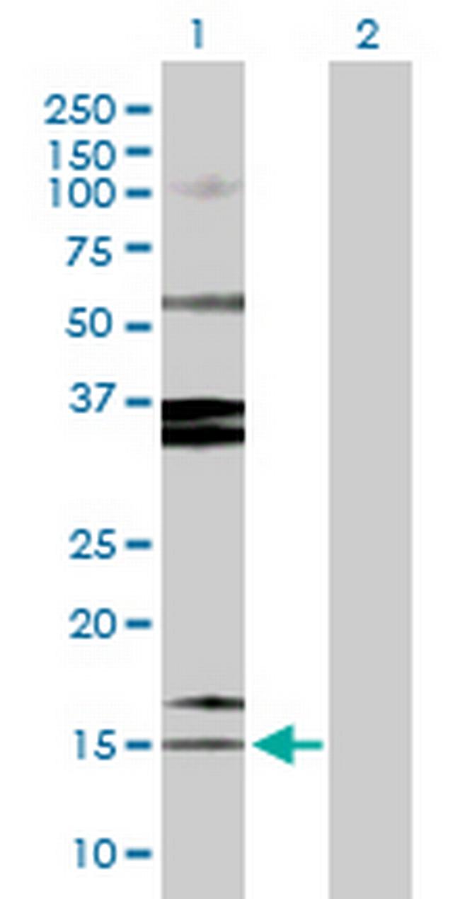 SPINK1 Antibody in Western Blot (WB)