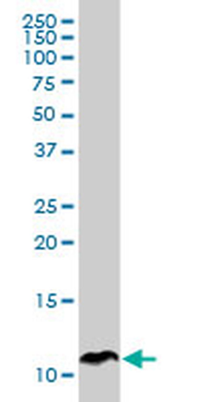 SPINK1 Antibody in Western Blot (WB)