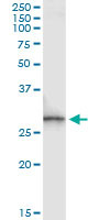 SPR Antibody in Immunoprecipitation (IP)