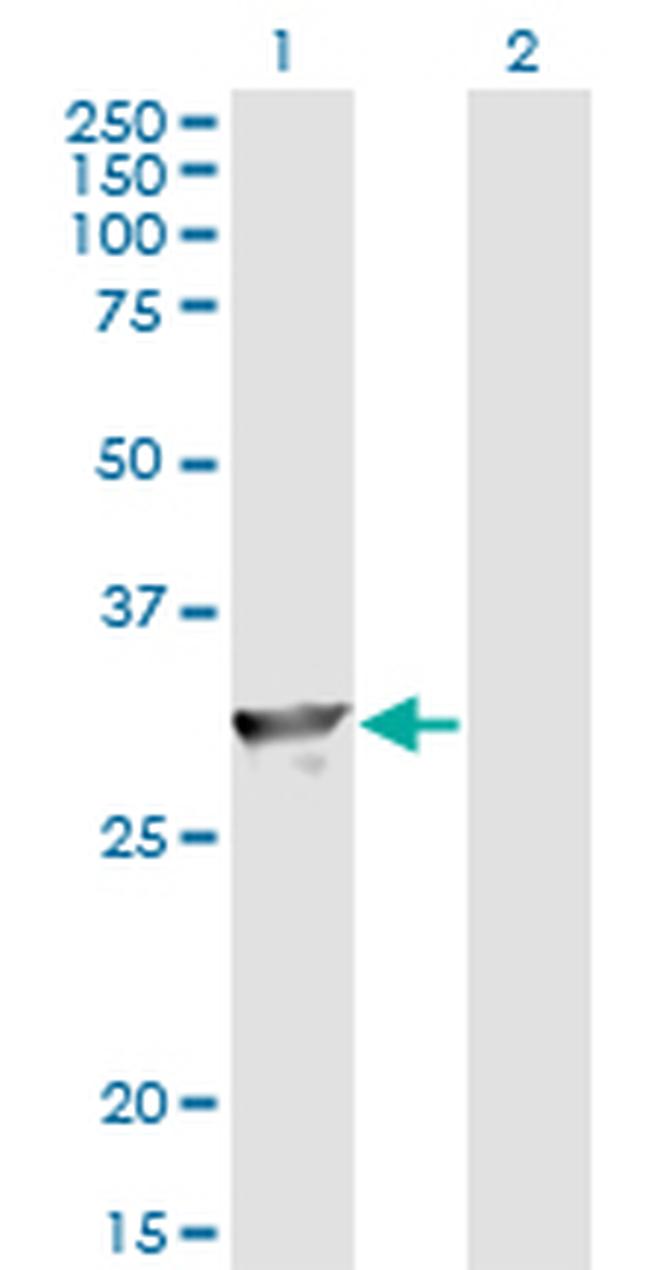 SPR Antibody in Western Blot (WB)