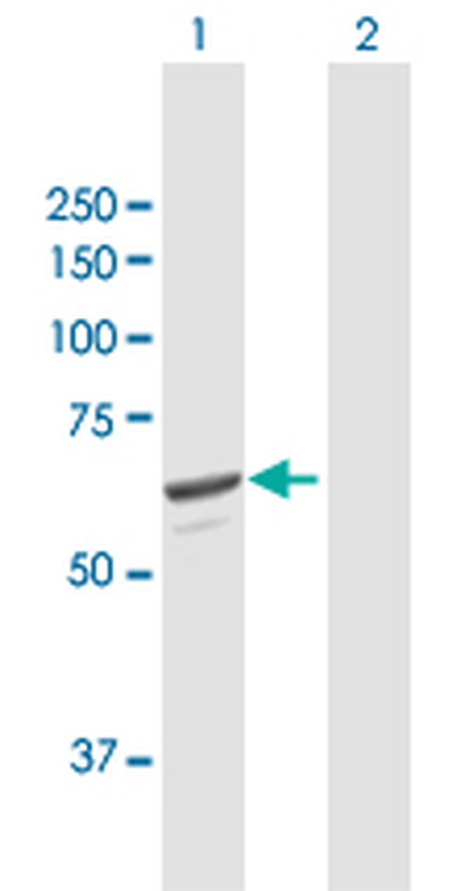 SQLE Antibody in Western Blot (WB)