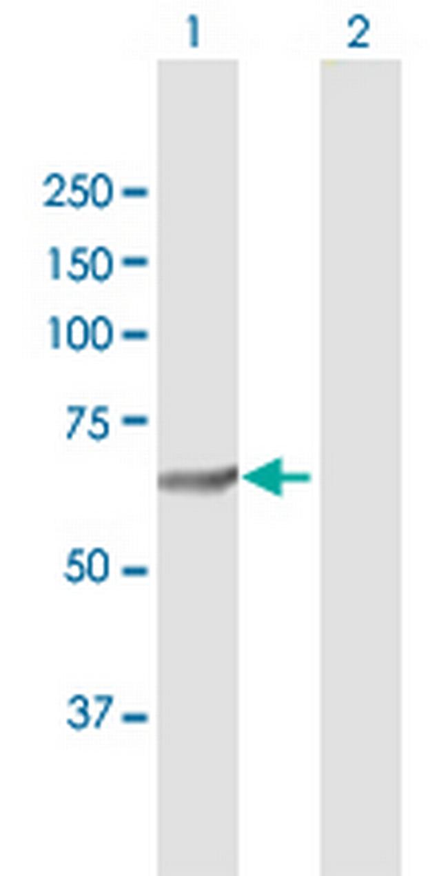 SQLE Antibody in Western Blot (WB)