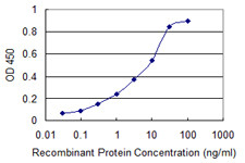 SRD5A2 Antibody in ELISA (ELISA)