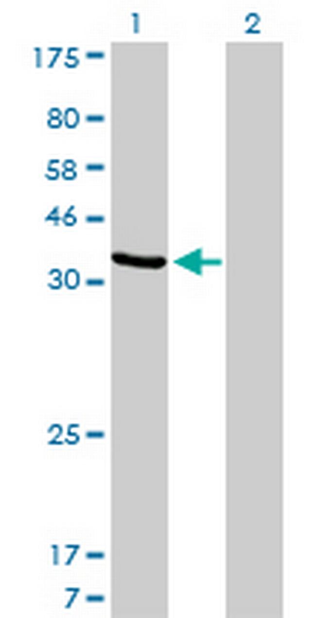 AKR1D1 Antibody in Western Blot (WB)