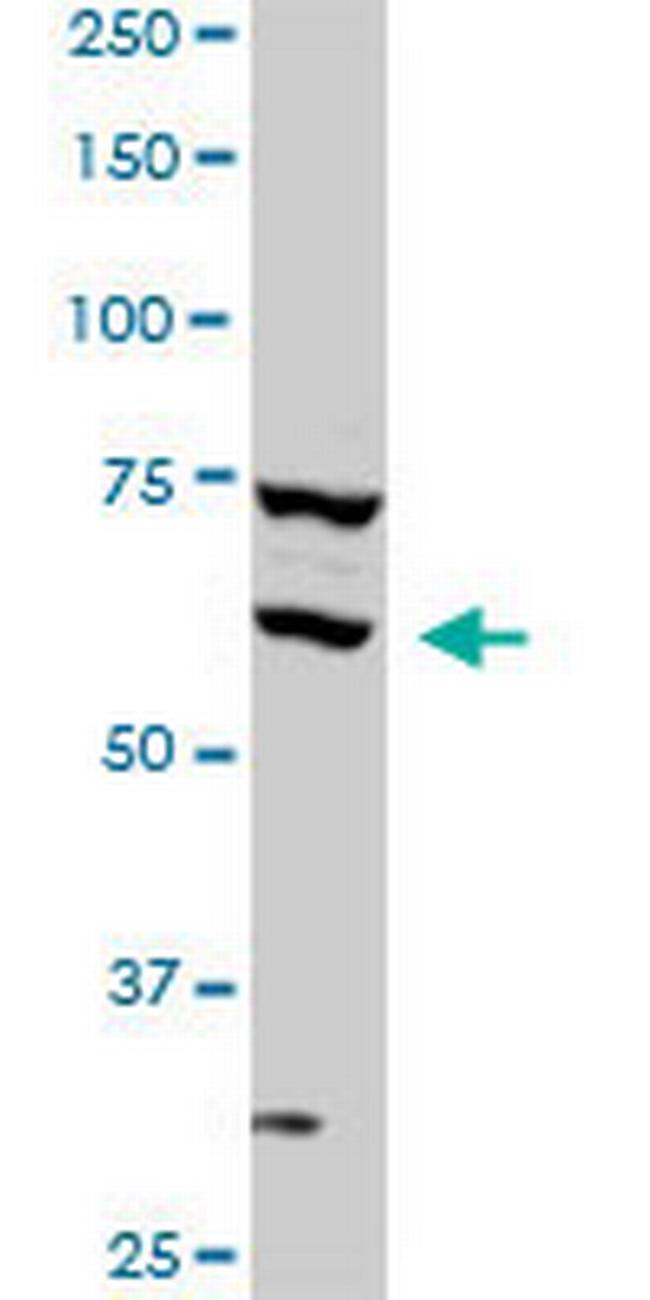 SREBF1 Antibody in Western Blot (WB)