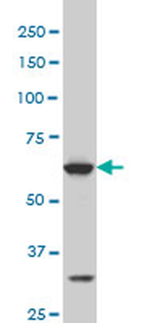 SREBF1 Antibody in Western Blot (WB)