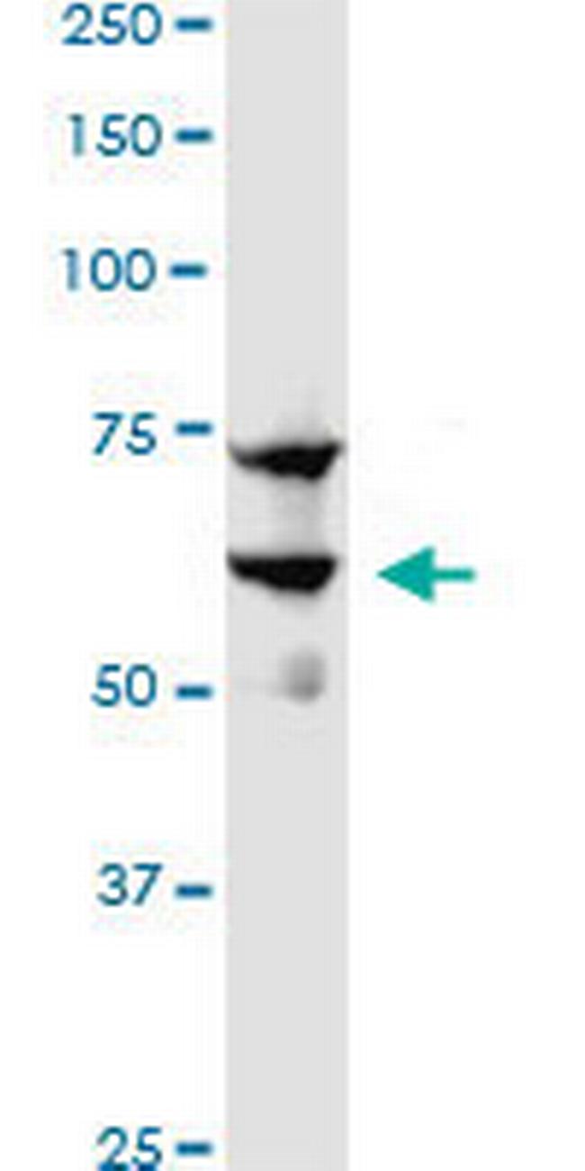 SREBF1 Antibody in Western Blot (WB)