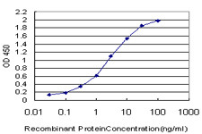 SRF Antibody in ELISA (ELISA)