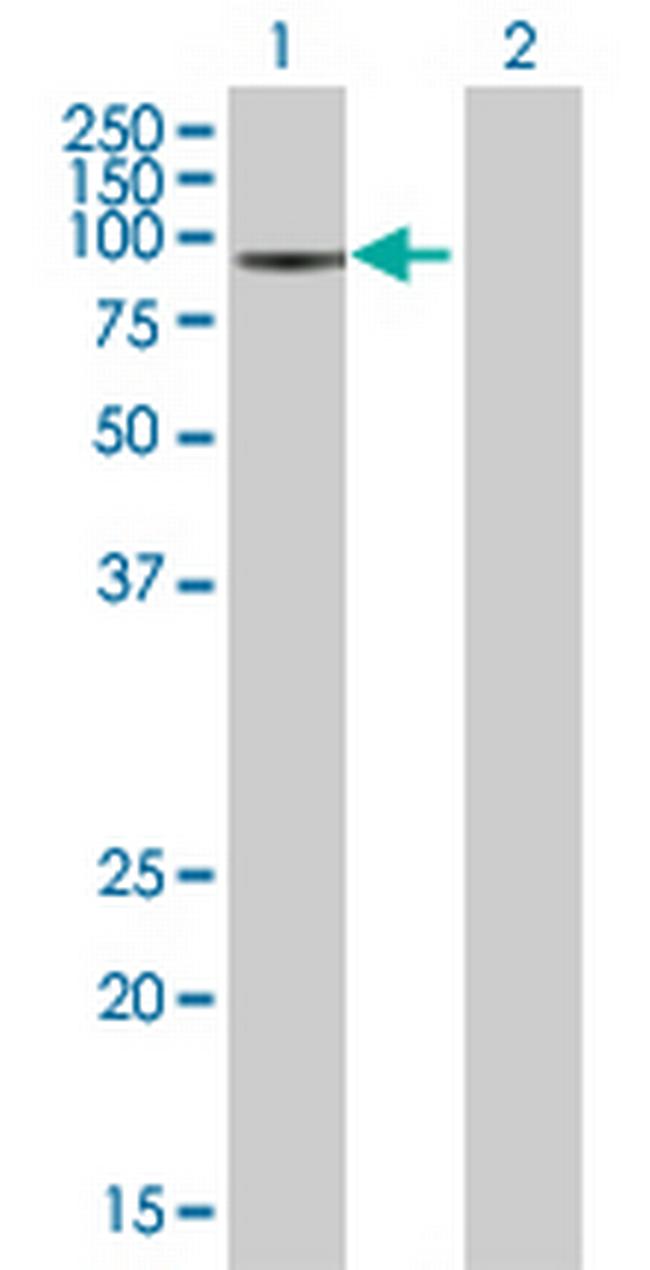 SRPK1 Antibody in Western Blot (WB)