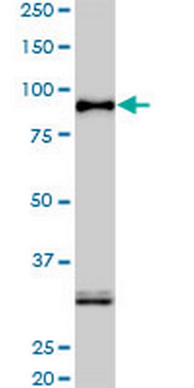 SRPK1 Antibody in Western Blot (WB)