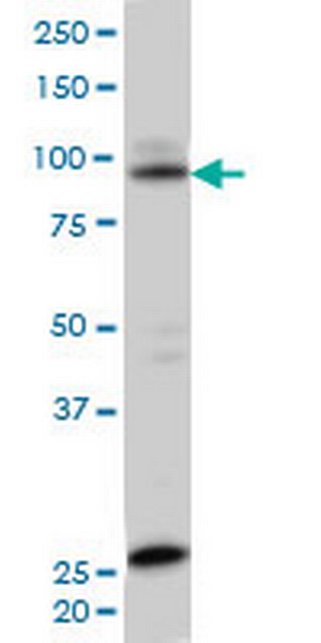 SRPK1 Antibody in Western Blot (WB)