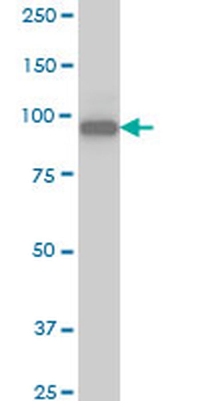 SRPK1 Antibody in Western Blot (WB)