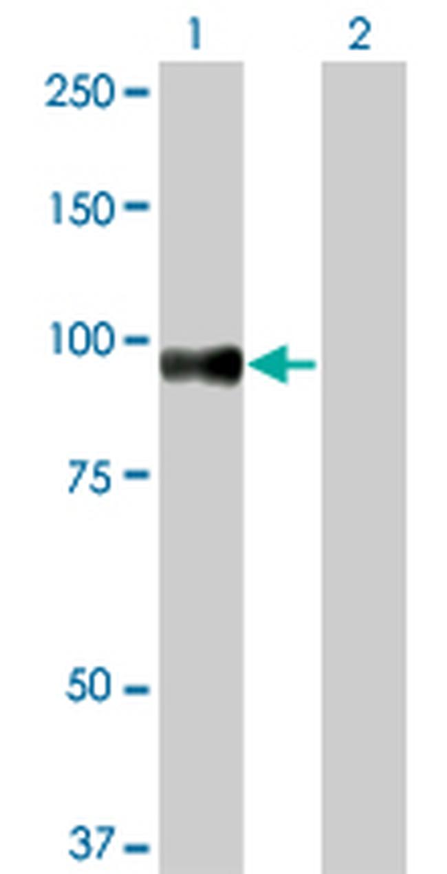 SRPK1 Antibody in Western Blot (WB)