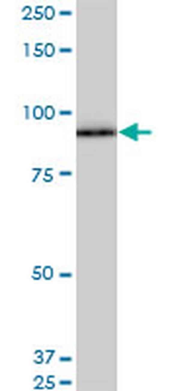 SRPK1 Antibody in Western Blot (WB)