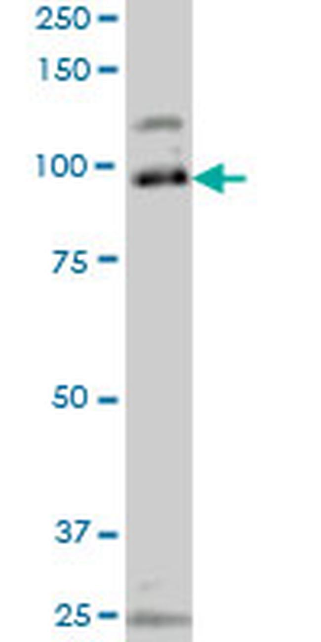 SRPK1 Antibody in Western Blot (WB)