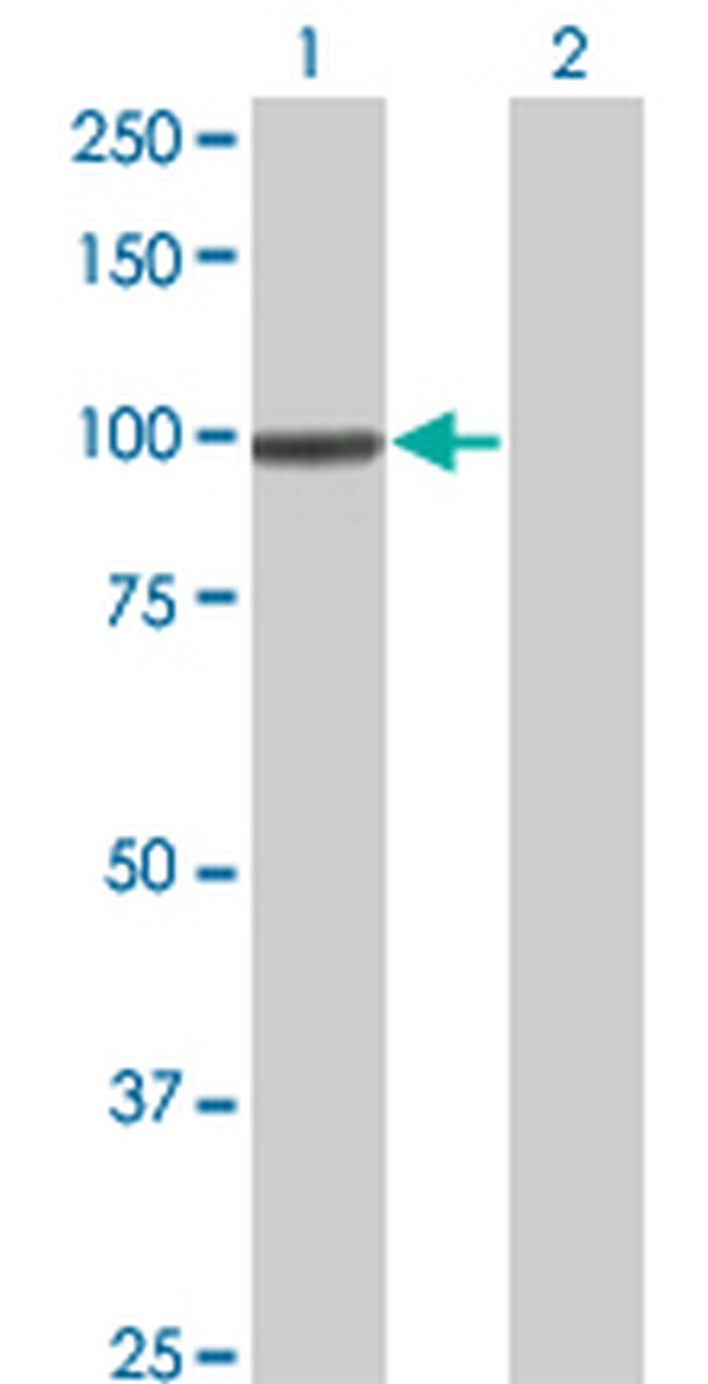 SRPK1 Antibody in Western Blot (WB)