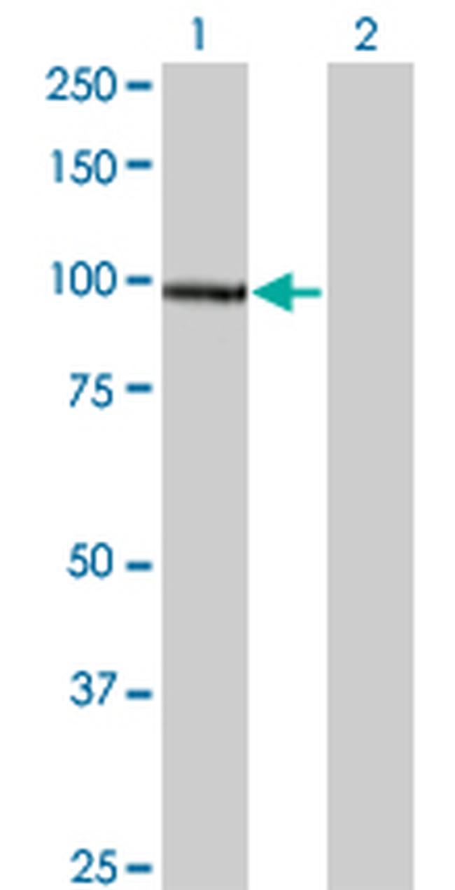 SRPK1 Antibody in Western Blot (WB)